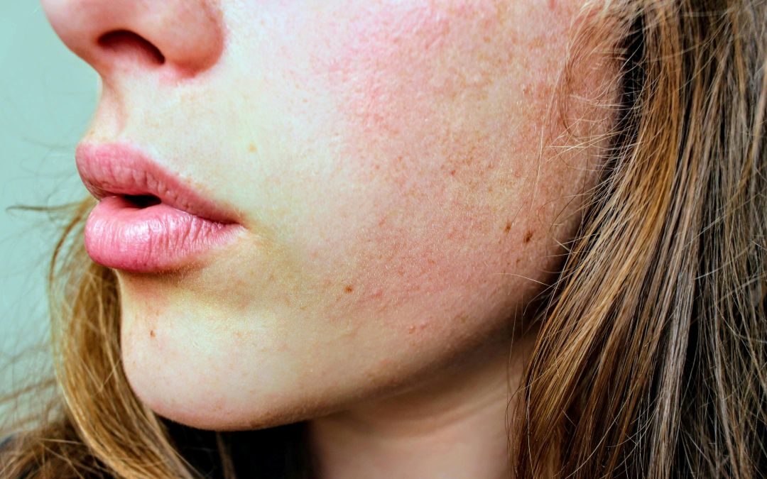 Teenage Skincare (13–19): You Don’t Need Perfect Skin, You Need Real Care